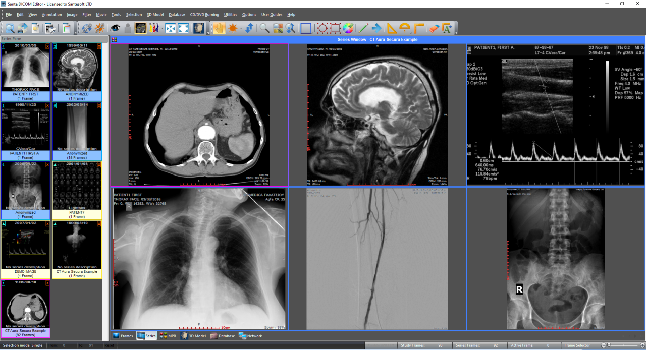 Sante DICOM Editor特别版注册机序列号 DICOM医学影像编辑器 v10.0.15